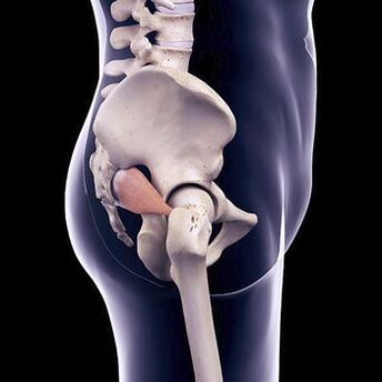 Back pain may be due to spasm of the piriformis muscle