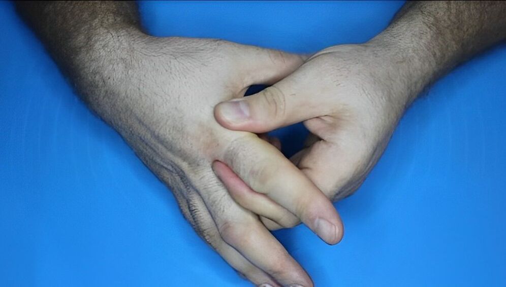 exercises for fingers with arthrosis