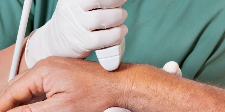 arthritis as the causes of pain in the joints of the fingers